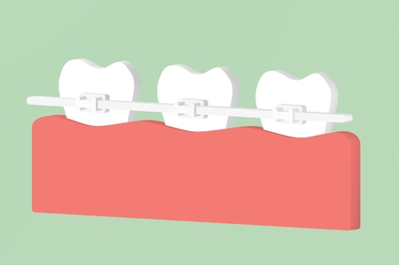 orthodontic teeth or dental braces - tooth cartoon 3d render flat style cute character for designの写真素材