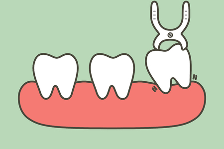 tooth extraction by dental tools to remove wisdom tooth - teeth cartoon vector flat style cute character for designのイラスト素材
