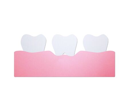 periodontitis or gum disease, dental problem - teeth cartoon paper cut style cute character for designの写真素材