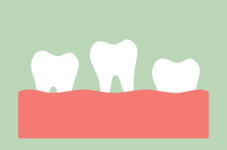 loose tooth, tooth is fall out of the gum - dental cartoon vector flat style cute character for designのイラスト素材
