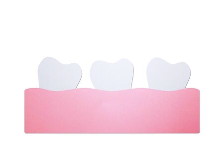 crowding teeth (malocclusion) or crooked teeth, dental problem - tooth cartoon paper cut style cute character for designの写真素材