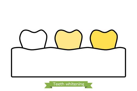 white to yellow tooth, teeth whitening before and after concept - dental cartoon vector outline flat style cute character for designのイラスト素材
