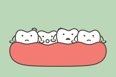 crowding teeth (malocclusion), dental problem - tooth cartoon vector flat style cute character for designのイラスト素材