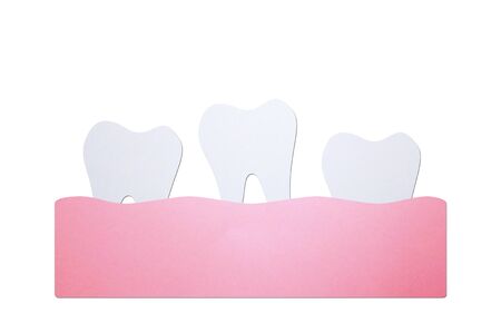 loose tooth or missing teeth, tooth is fall out of the gum - dental cartoon paper cut style cute character for designの写真素材