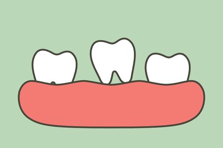 loose tooth, tooth is fall out of the gum - dental cartoon vector flat style cute character for designのイラスト素材