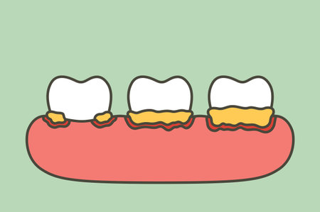 step of periodontitis or gum disease that is inflamed and has blood - dental cartoon vector flat style cute character for designのイラスト素材