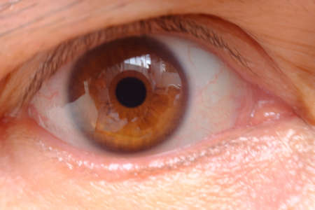 A closeup shot of the eye of a woman with red eyes