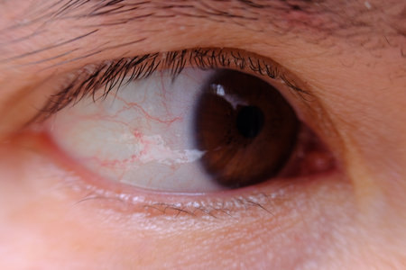 Close-up of a human eye with blood vessels in the eye.の写真素材