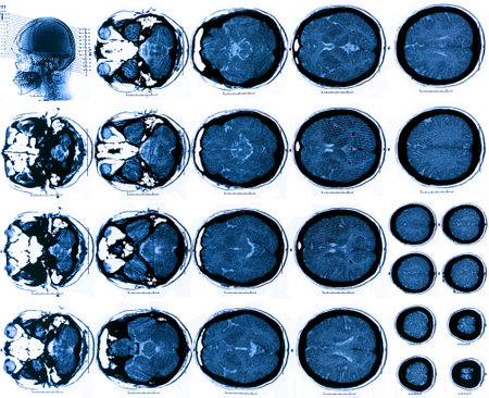 X-Ray scan human for brain