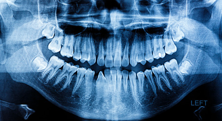 Photo X-Ray scan human の写真素材