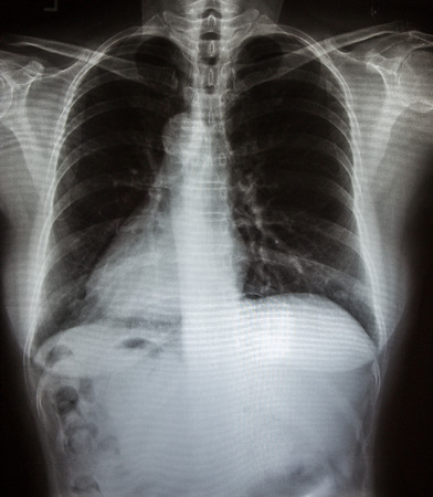 X-Ray scan humanの写真素材