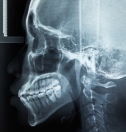X-Ray scan humanの写真素材