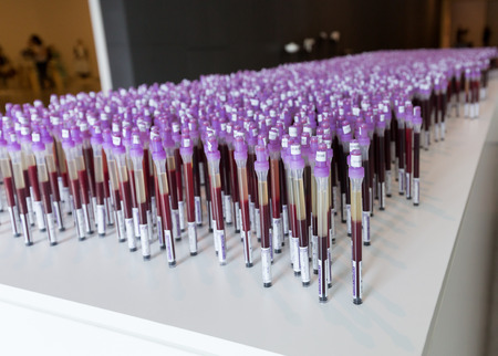 CRACOW, POLAND - APRIL 21, 2016: Cracow - MOCAK Museum of Contemporary Art. New exhibition - Medicine in Art. Edith Micansky, ESR (BSG), 2004, installationのeditorial素材