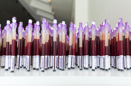 CRACOW, POLAND - APRIL 21, 2016: Cracow - MOCAK Museum of Contemporary Art. New exhibition - Medicine in Art. Edith Micansky, ESR (BSG), 2004, installationのeditorial素材