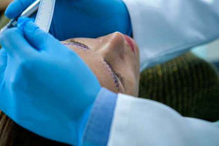 Doctor applies markings on the skin of the young woman patient's before the plastic surgery to correct the eyebrowsの写真素材