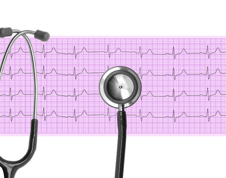 Heart analysis, electrocardiogram graph (ECG) and Stethoscopeの写真素材