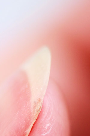 slightly split long thumbnail on the girl s thumb of hand. macro photographyの写真素材