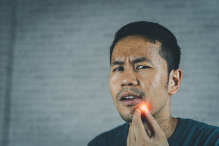 Man with acne problem squishing pimples. Man pointing acne Inflamed occur on his face.の写真素材