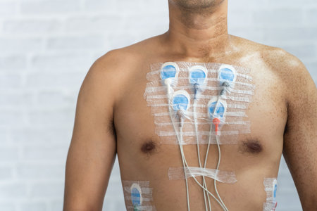 Man wearing 24 hrs electrocardiogram monitor device on his chest, Electrodes rhythm Holter monitoring and blood pressure monitor system on the chest of a man. Health care heart disease concept.の写真素材
