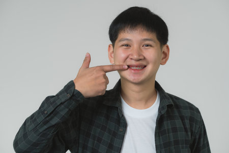 Happy Asian Teen Boy Pointing at Braces. Smiling Asian teenager man pointing at his dental braces on a light grey background. Portrait handsome man in studio concept.の写真素材