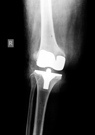 X-rayの写真素材