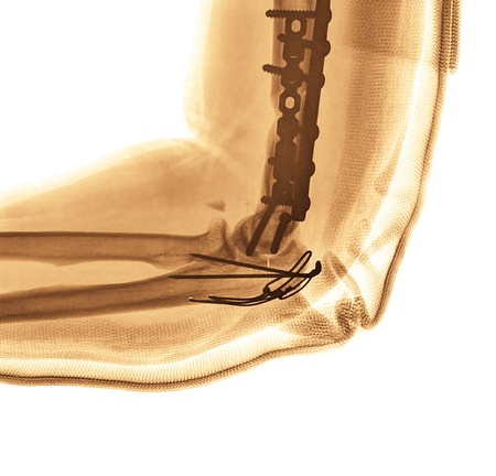 X-rayの写真素材