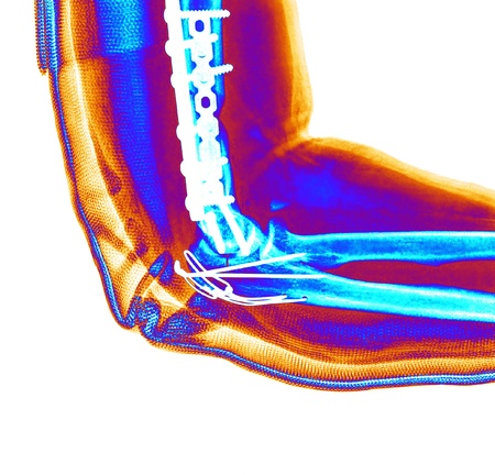 X-rayの写真素材