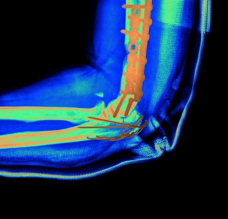 X-rayの写真素材