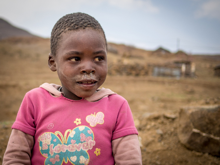 Mokhotlong, Lesotho - September 11, 2016: Unidentified young African girl with short hair and running noseのeditorial素材