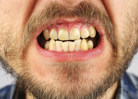 closed human uneven teeth grin, small gap, closeupの写真素材