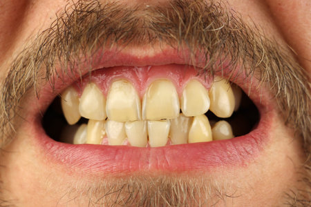 closed human uneven teeth grin, closeup, macro