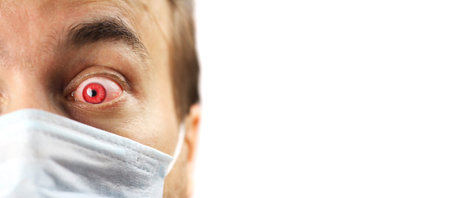 isolated close-up man face with red eye and medical mask, infected patient looks with fright, virus...
