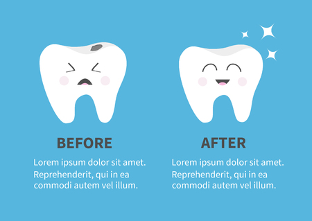 Healthy smiling tooth icon. Shining star. Crying bad ill teeth with caries. Before after Infographic Template with text. Cute character. Oral dental hygiene. Baby background. Flat design. Vectorのイラスト素材