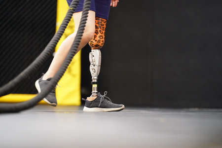Young female with one prosthetic leg with doing arm and shoulder exercises with a rope to practice balancing with prosthetic leg, Concept of life of women with prosthetic legs.の写真素材