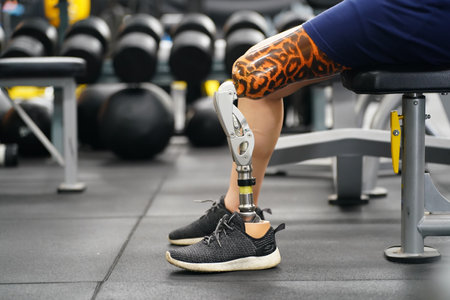 Young female with one prosthetic leg with the practice of using prosthetic legs to walk, exercise and and daily activitiesの写真素材