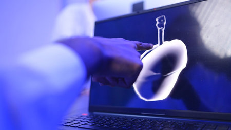 Doctors and medical professionals discuss preparing for lung surgery with futuristic hologram...