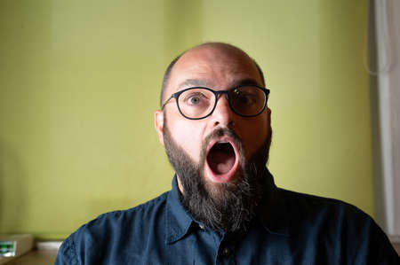 Man stares at the camera with his mouth wide open
