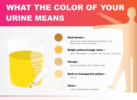 The color of urine can tell the health.のイラスト素材
