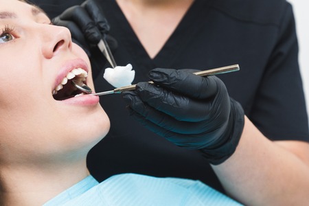 Dental clinic. Reception, examination of the patient. Teeth care. Work of stomatologist with patientの写真素材