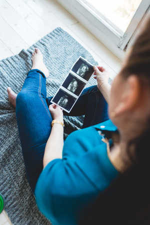 pregnancy, gynecology, medicine, health care and people concept - Pregnant woman holding ultrasound imageの写真素材