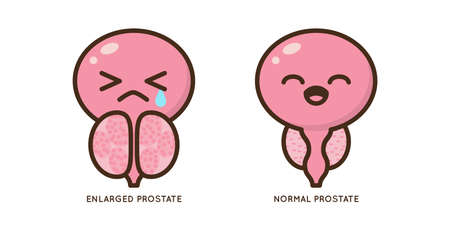 Cartoon benign and prostate vector illustration. Icon character of male urology inflammation...