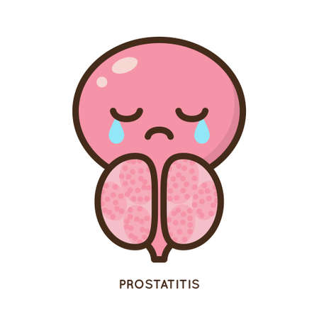 Cartoon benign and prostate vector illustration. Icon character of male urology inflammation disease. Flat design for diagram, medical journal article. Prostatitis, enlarged,obstruction,hypertrophyのイラスト素材