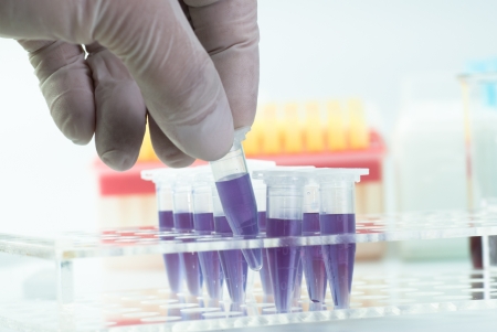 a vials in hand