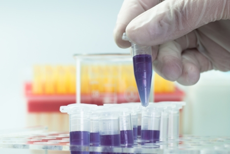 a vials in hand