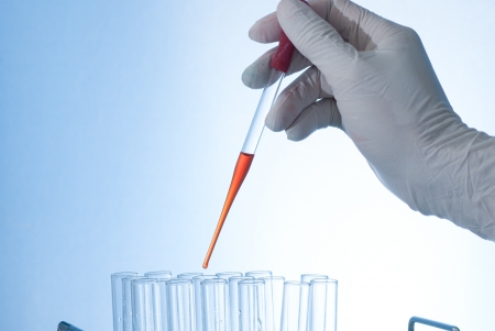 test tubes and pipetteの写真素材