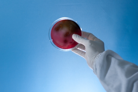 check the result of microbiology Experimentの写真素材