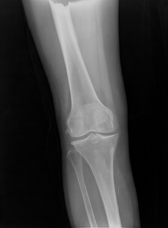 x-ray imageの写真素材