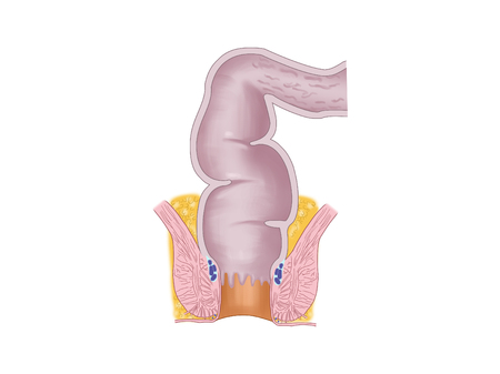 The rectumの写真素材