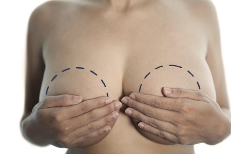 Woman holding her breast with marks isolated on whiteの写真素材