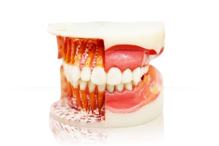 Closeup of denture isolated on white background